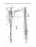 FLEXIBLE ENDOSCOPIC STITCHING DEVICES diagram and image