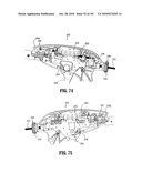 FLEXIBLE ENDOSCOPIC STITCHING DEVICES diagram and image