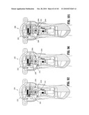 FLEXIBLE ENDOSCOPIC STITCHING DEVICES diagram and image