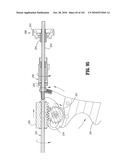 FLEXIBLE ENDOSCOPIC STITCHING DEVICES diagram and image