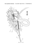 FLEXIBLE ENDOSCOPIC STITCHING DEVICES diagram and image