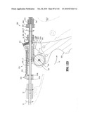 FLEXIBLE ENDOSCOPIC STITCHING DEVICES diagram and image