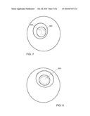 Instrument And Method For Creating A Controlled Capsulorhexis For Cataract Surgery diagram and image