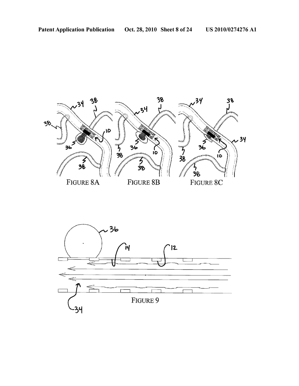 ANEURYSM TREATMENT SYSTEM, DEVICE AND METHOD - diagram, schematic, and image 09
