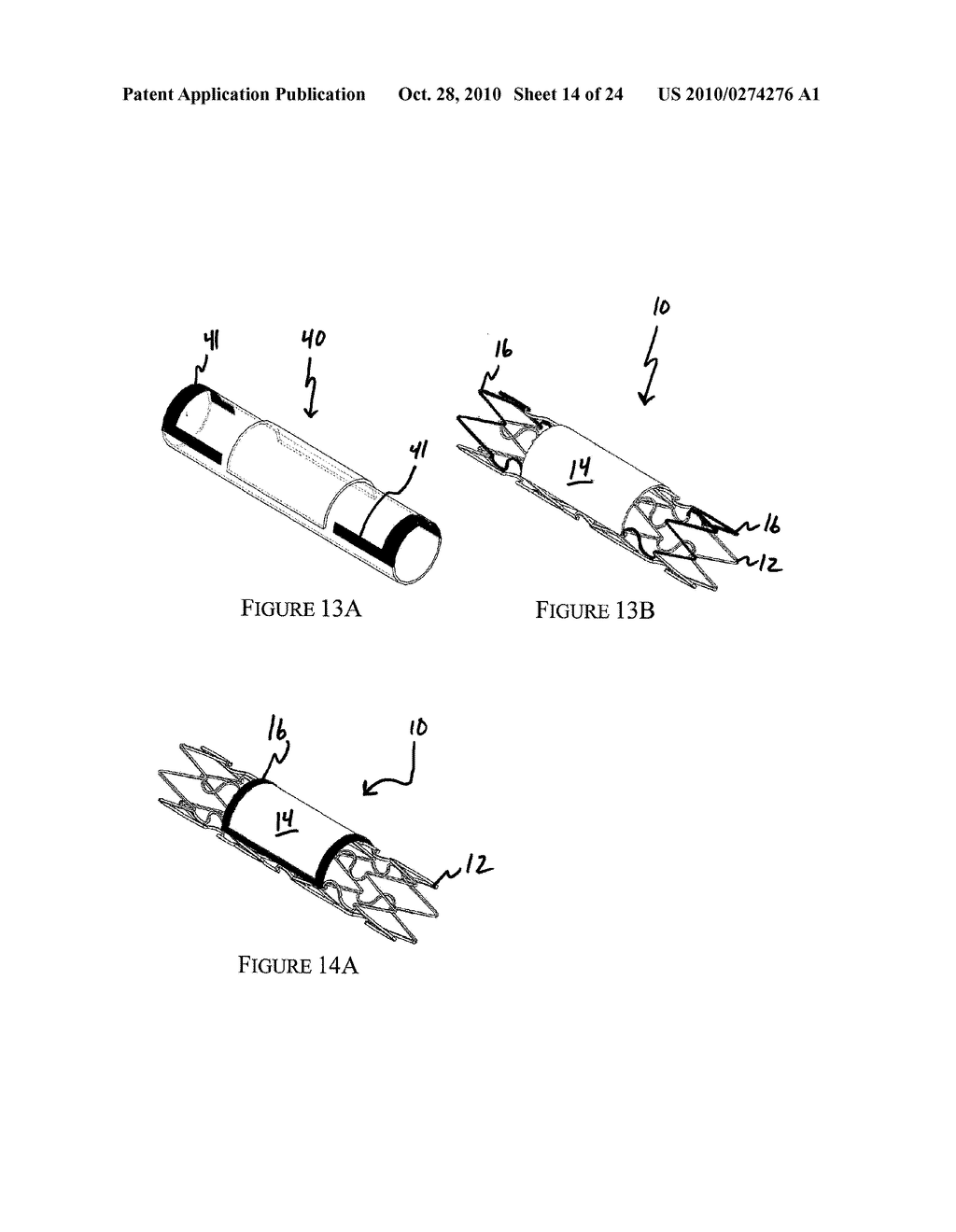 ANEURYSM TREATMENT SYSTEM, DEVICE AND METHOD - diagram, schematic, and image 15