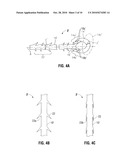 ANCHORING DEVICE diagram and image