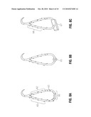 ANCHORING DEVICE diagram and image