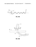 ANCHORING DEVICE diagram and image