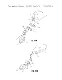 ANCHORING DEVICE diagram and image