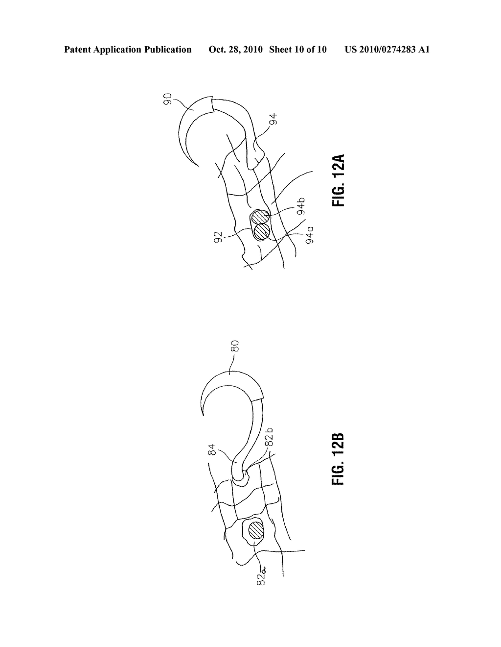 ANCHORING DEVICE - diagram, schematic, and image 11