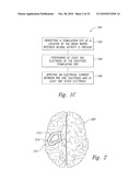 METHOD AND APPARATUS FOR ELECTRICALLY STIMULATING CELLS IMPLANTED IN THE NERVOUS SYSTEM diagram and image