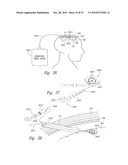 METHOD AND APPARATUS FOR ELECTRICALLY STIMULATING CELLS IMPLANTED IN THE NERVOUS SYSTEM diagram and image