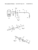 SYSTEMS AND METHODS FOR THE TREATMENT OF BLADDER DYSFUNCTIONS USING NEUROMODULATION diagram and image