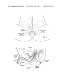 SYSTEMS AND METHODS FOR THE TREATMENT OF BLADDER DYSFUNCTIONS USING NEUROMODULATION diagram and image