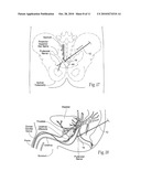 SYSTEMS AND METHODS FOR THE TREATMENT OF BLADDER DYSFUNCTIONS USING NEUROMODULATION diagram and image