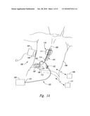 SELECTIVE HIGH FREQUENCY SPINAL CORD MODULATION FOR INHIBITING PAIN WITH REDUCED SIDE EFFECTS, AND ASSOCIATED SYSTEMS AND METHODS diagram and image