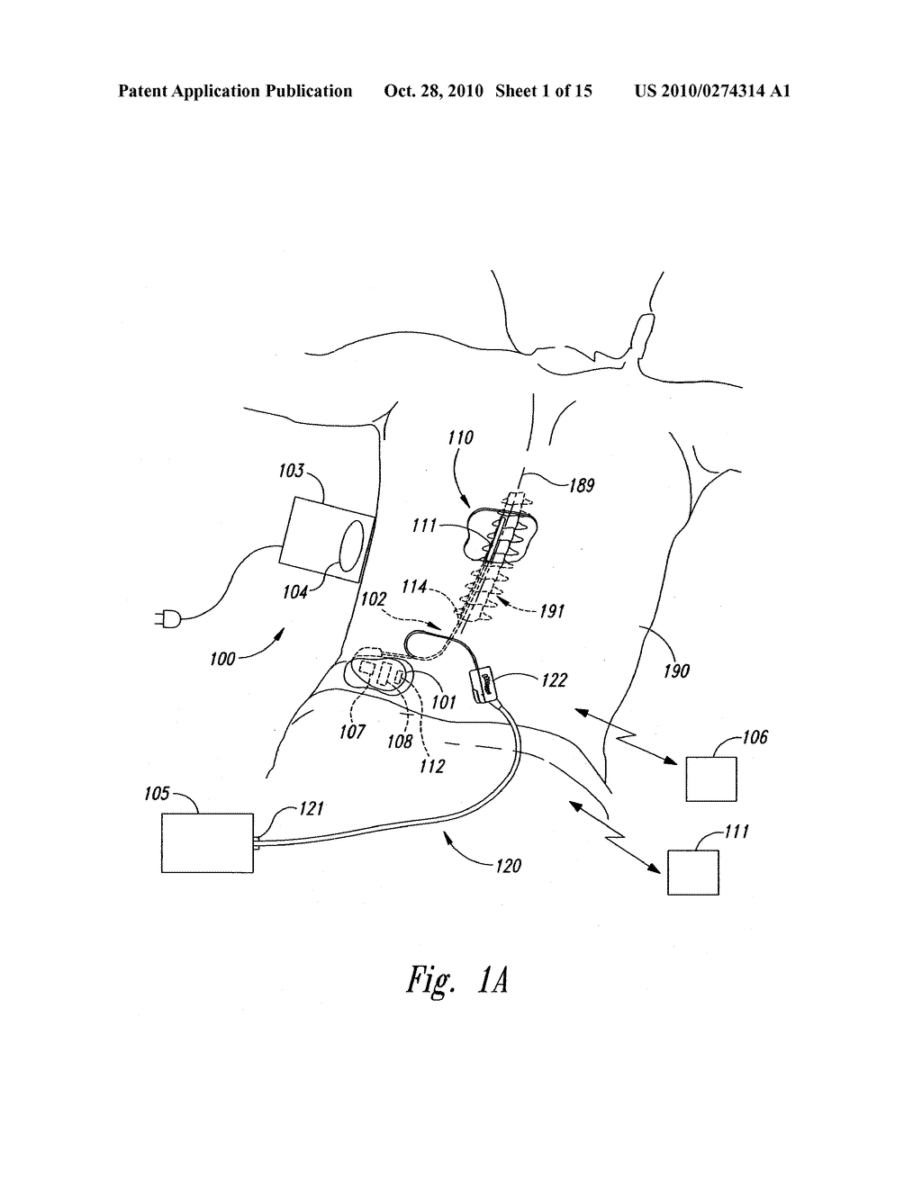 SELECTIVE HIGH FREQUENCY SPINAL CORD MODULATION FOR INHIBITING PAIN WITH REDUCED SIDE EFFECTS, AND ASSOCIATED SYSTEMS AND METHODS - diagram, schematic, and image 02