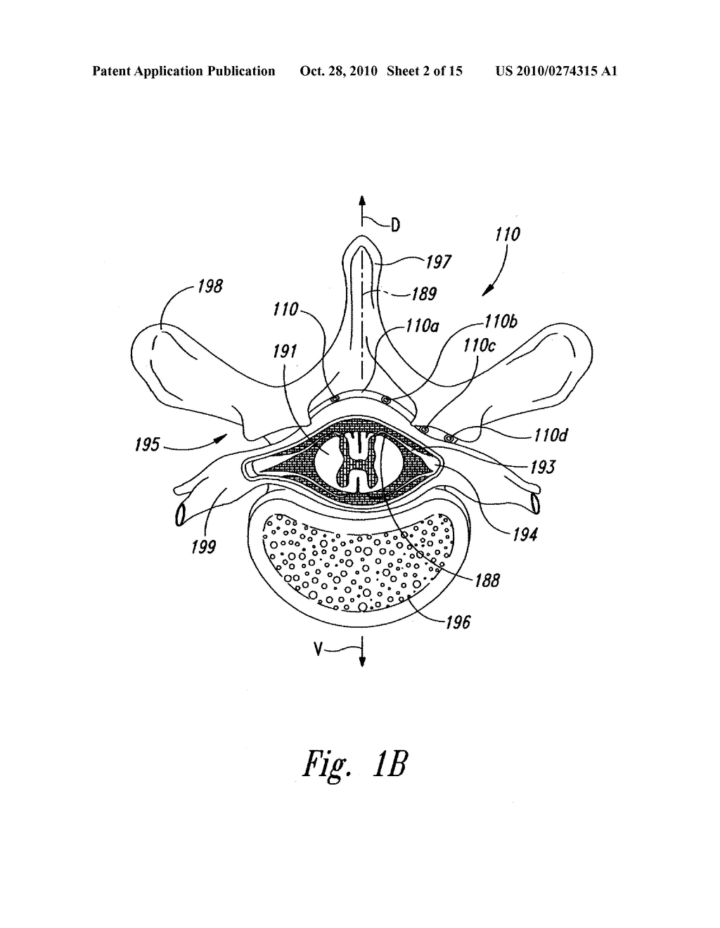 SELECTIVE HIGH FREQUENCY SPINAL CORD MODULATION FOR INHIBITING PAIN WITH REDUCED SIDE EFFECTS, AND ASSOCIATED SYSTEMS AND METHODS, INCLUDING PRACTITIONER PROCESSES - diagram, schematic, and image 03