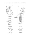 DEVICE FOR TREATMENT OF BLOOD VESSELS USING LIGHT diagram and image