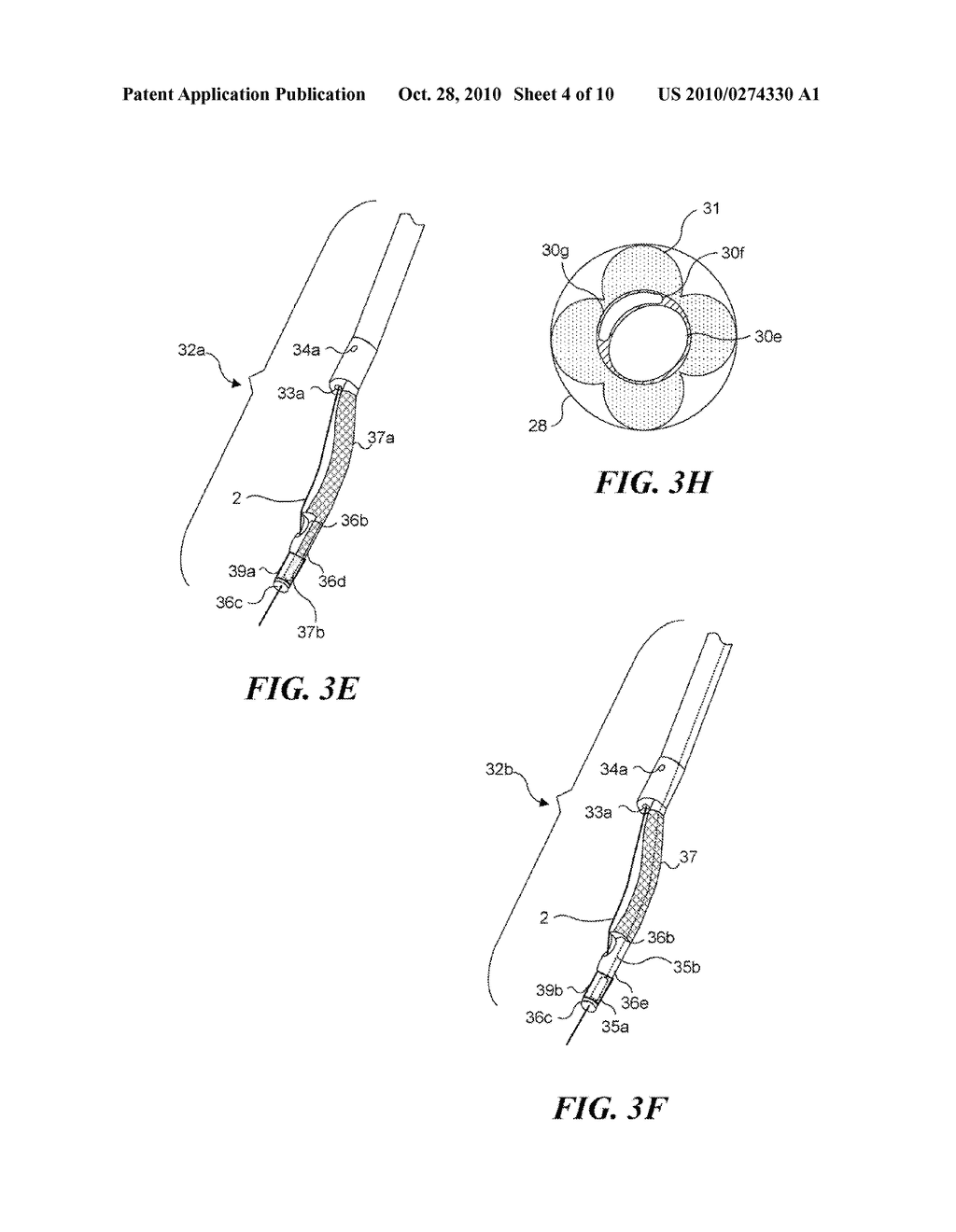 DEVICE FOR TREATMENT OF BLOOD VESSELS USING LIGHT - diagram, schematic, and image 05