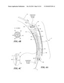 DEVICE FOR TREATMENT OF BLOOD VESSELS USING LIGHT diagram and image