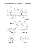 DEVICE FOR TREATMENT OF BLOOD VESSELS USING LIGHT diagram and image