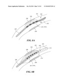 DEVICE FOR TREATMENT OF BLOOD VESSELS USING LIGHT diagram and image