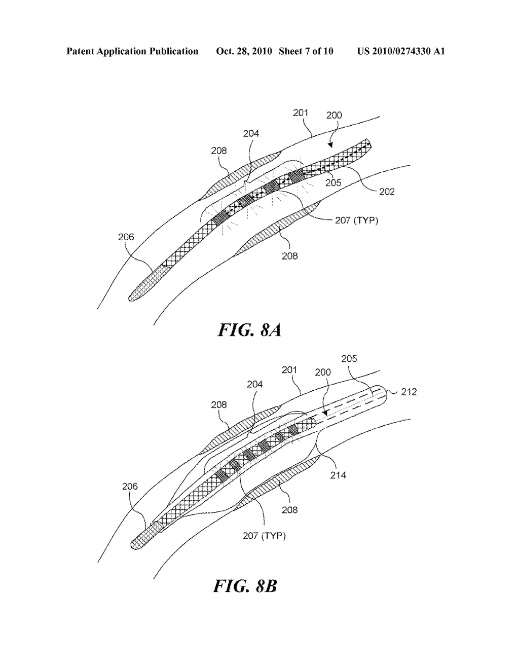 DEVICE FOR TREATMENT OF BLOOD VESSELS USING LIGHT - diagram, schematic, and image 08