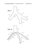 Delivery System for Deployment of a One-Piece Iliac-Branch Device diagram and image