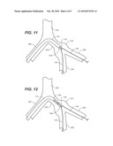 Delivery System for Deployment of a One-Piece Iliac-Branch Device diagram and image