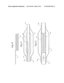 Stent Delivery System Having Stent Securement Apparatus diagram and image