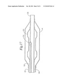 Stent Delivery System Having Stent Securement Apparatus diagram and image
