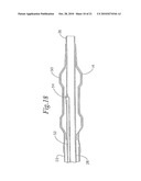 Stent Delivery System Having Stent Securement Apparatus diagram and image