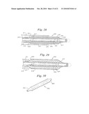 Stent Delivery System Having Stent Securement Apparatus diagram and image