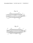 Stent Delivery System Having Stent Securement Apparatus diagram and image