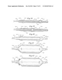 Stent Delivery System Having Stent Securement Apparatus diagram and image