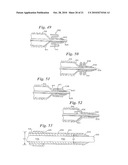 Stent Delivery System Having Stent Securement Apparatus diagram and image