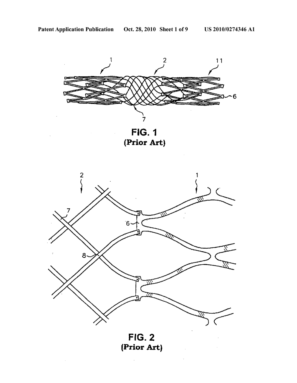 MULTI-SECTION FILAMENTARY ENDOLUMINAL STENT - diagram, schematic, and image 02