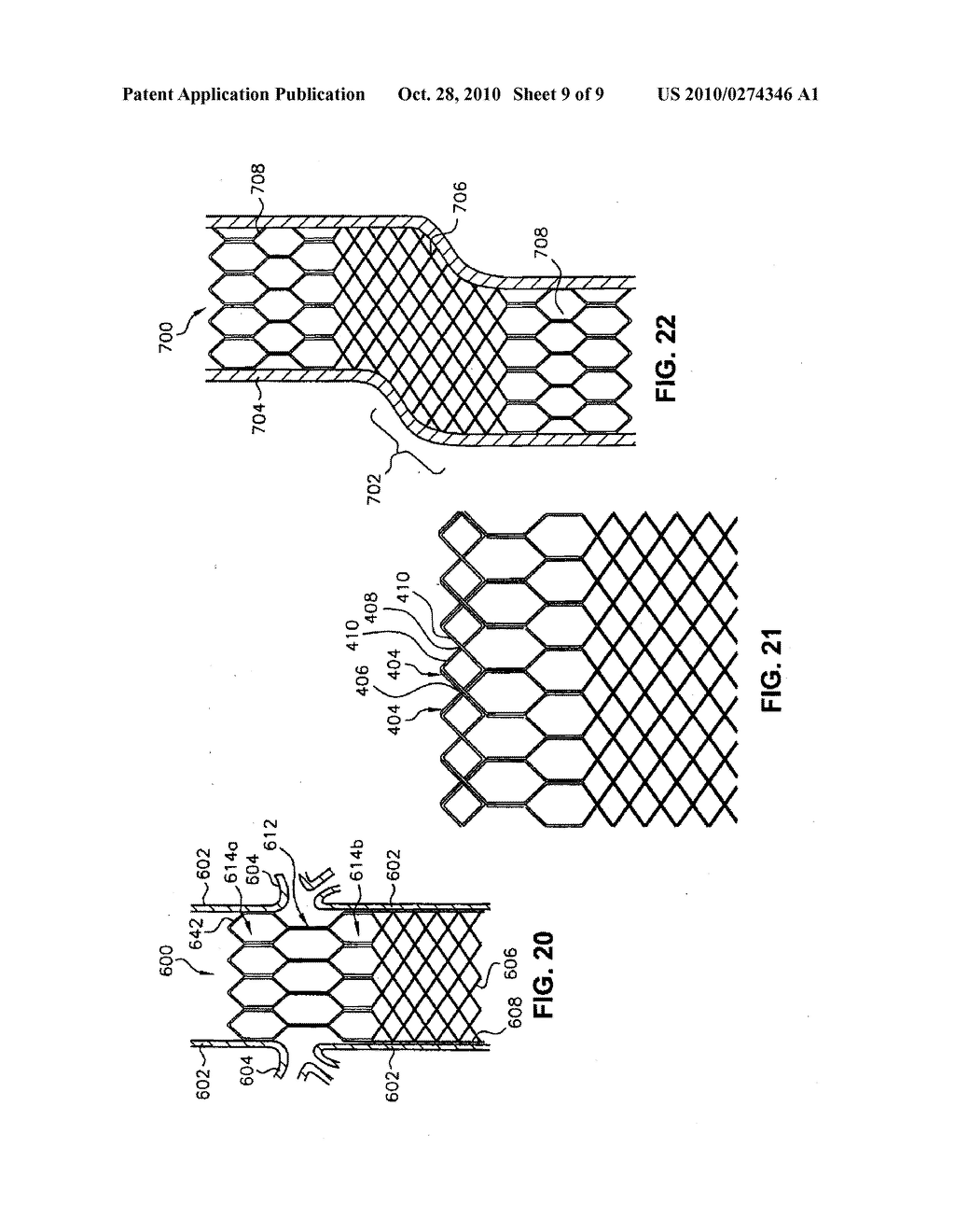 MULTI-SECTION FILAMENTARY ENDOLUMINAL STENT - diagram, schematic, and image 10