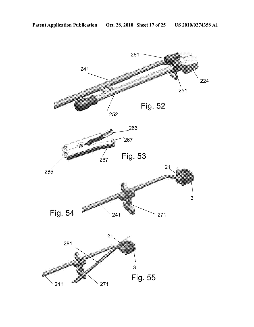 SPINE STABILIZATION DEVICE, AND METHOD AND KIT FOR ITS IMPLANTATION - diagram, schematic, and image 18