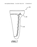 ADJUSTABLE PROSTHESIS diagram and image