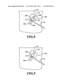 ADJUSTABLE PROSTHESIS diagram and image