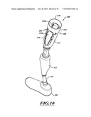 ADJUSTABLE PROSTHESIS diagram and image