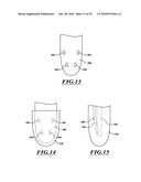 ADJUSTABLE PROSTHESIS diagram and image