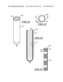 ADJUSTABLE PROSTHESIS diagram and image