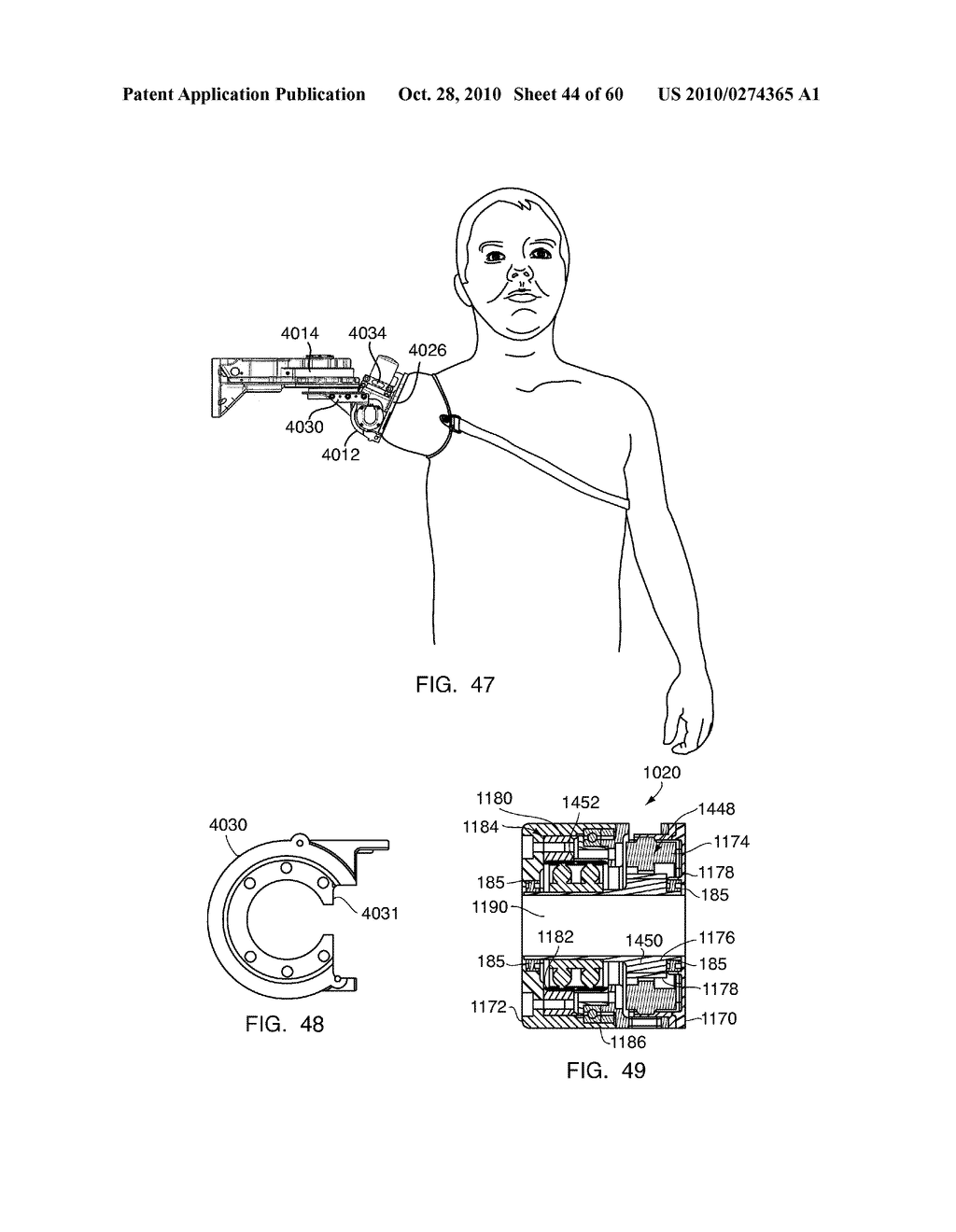 ARM PROSTHETIC DEVICE - diagram, schematic, and image 45