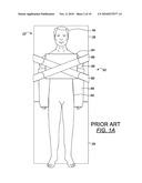 OPERATING TABLE PATIENT POSITIONER AND METHOD diagram and image