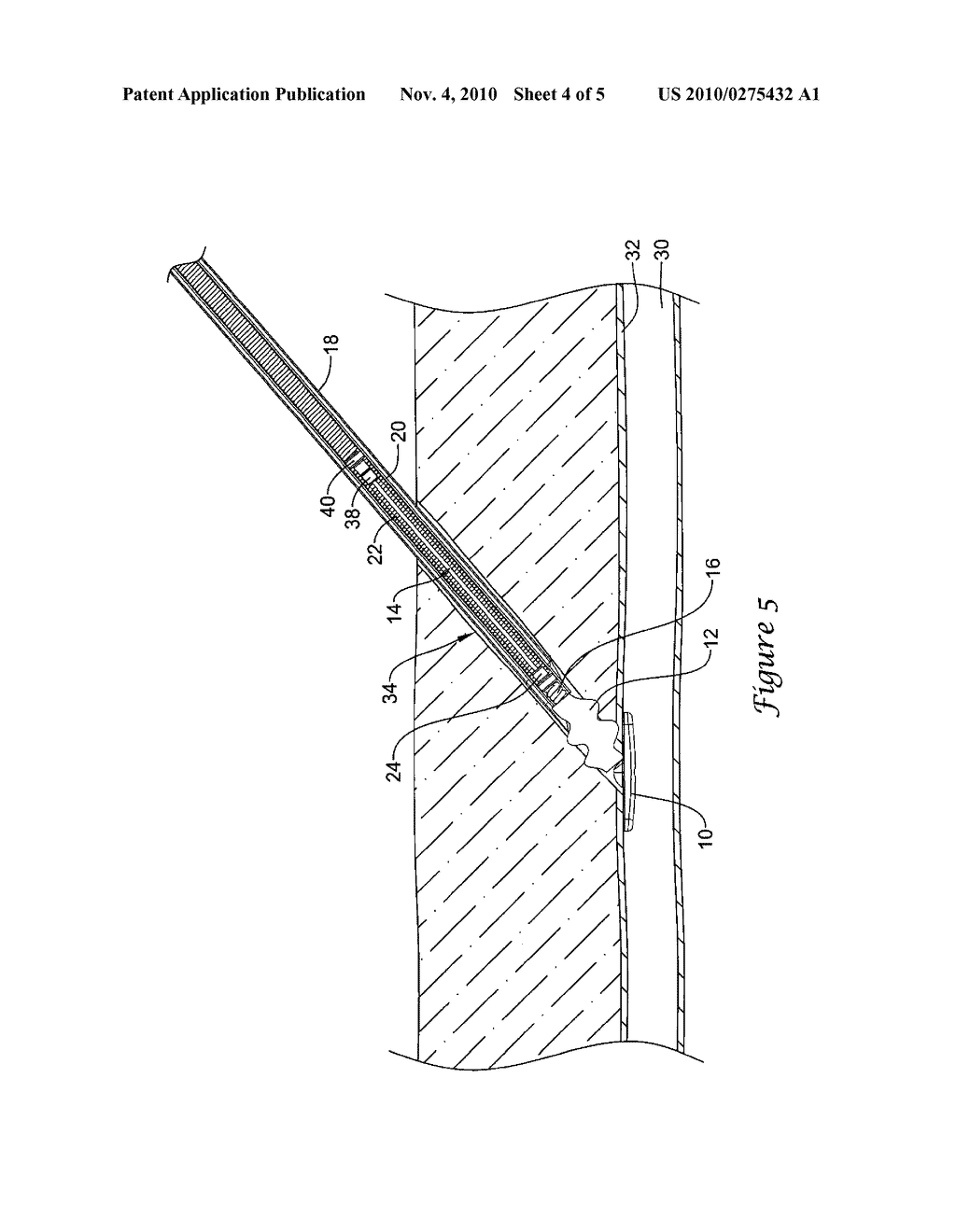 LOCKING ELEMENT FOR VASCULAR CLOSURE DEVICE - diagram, schematic, and image 05