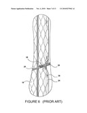 FLEXIBLE SIZE ADJUSTABLE FILTER ELEMENT WITH END-CAP diagram and image