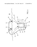 APPARATUS AND METHOD FOR COLLECTING MATERIAL FROM WATER SYSTEMS diagram and image